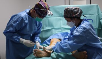Mengapa Dokter Jantung menangani Varises?