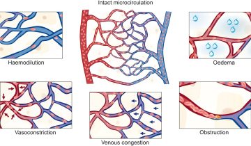 Microcirculation Matters: Peran Pembuluh Darah Mikro pada Kesehatan Kulit & Vaskular