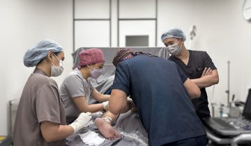 Tidak Semua Varises Bisa Ditangani dengan Cara yang Sama