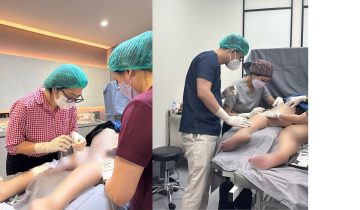 Bingung Soal Biaya Pengobatan Varises? Kenali Dulu Kondisinya